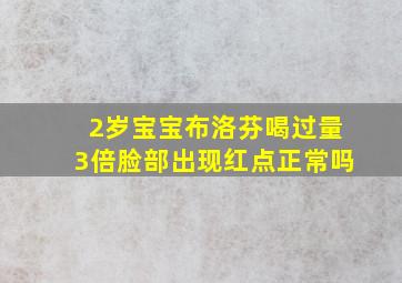 2岁宝宝布洛芬喝过量3倍脸部出现红点正常吗