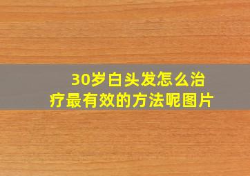 30岁白头发怎么治疗最有效的方法呢图片