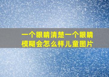 一个眼睛清楚一个眼睛模糊会怎么样儿童图片