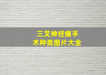 三叉神经痛手术种类图片大全