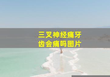 三叉神经痛牙齿会痛吗图片