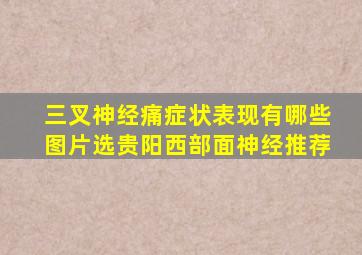 三叉神经痛症状表现有哪些图片选贵阳西部面神经推荐