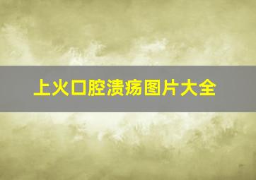 上火口腔溃疡图片大全