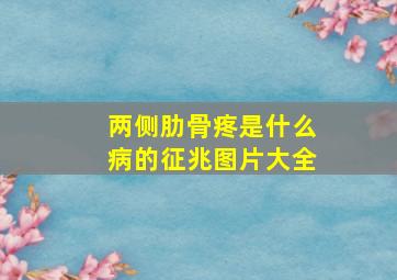 两侧肋骨疼是什么病的征兆图片大全