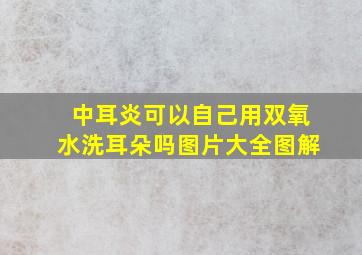 中耳炎可以自己用双氧水洗耳朵吗图片大全图解