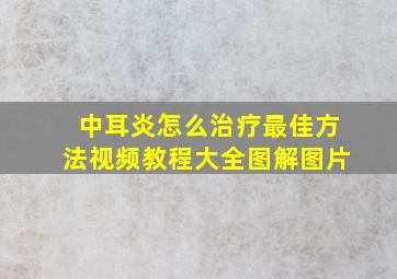 中耳炎怎么治疗最佳方法视频教程大全图解图片