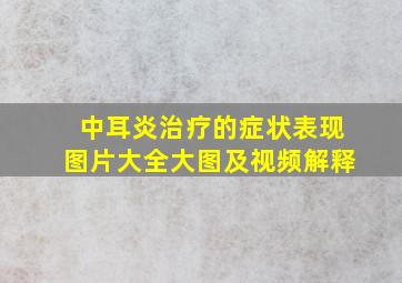 中耳炎治疗的症状表现图片大全大图及视频解释