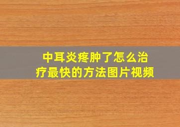 中耳炎疼肿了怎么治疗最快的方法图片视频