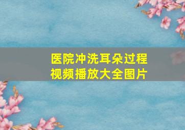 医院冲洗耳朵过程视频播放大全图片