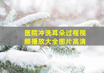 医院冲洗耳朵过程视频播放大全图片高清