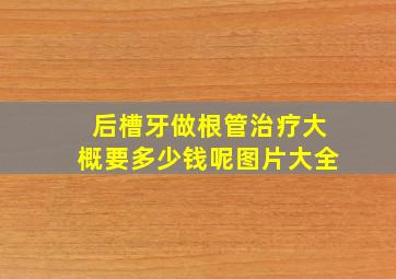 后槽牙做根管治疗大概要多少钱呢图片大全