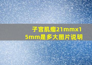 子宫肌瘤21mmx15mm是多大图片说明