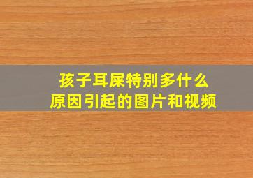 孩子耳屎特别多什么原因引起的图片和视频