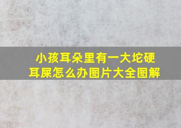 小孩耳朵里有一大坨硬耳屎怎么办图片大全图解