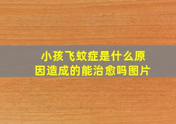 小孩飞蚊症是什么原因造成的能治愈吗图片