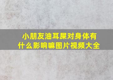 小朋友油耳屎对身体有什么影响嘛图片视频大全