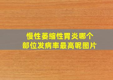 慢性萎缩性胃炎哪个部位发病率最高呢图片