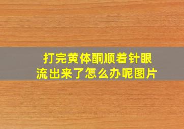 打完黄体酮顺着针眼流出来了怎么办呢图片