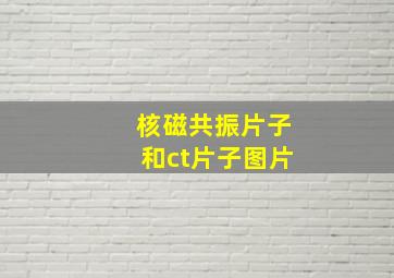 核磁共振片子和ct片子图片