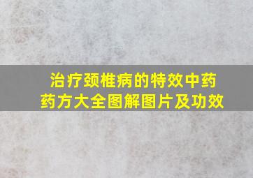 治疗颈椎病的特效中药药方大全图解图片及功效