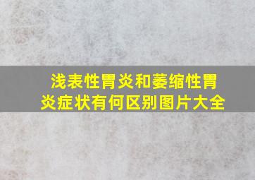 浅表性胃炎和萎缩性胃炎症状有何区别图片大全