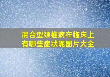 混合型颈椎病在临床上有哪些症状呢图片大全