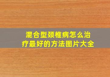 混合型颈椎病怎么治疗最好的方法图片大全