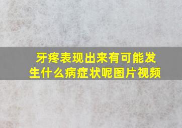 牙疼表现出来有可能发生什么病症状呢图片视频