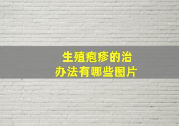 生殖疱疹的治办法有哪些图片