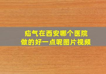 疝气在西安哪个医院做的好一点呢图片视频