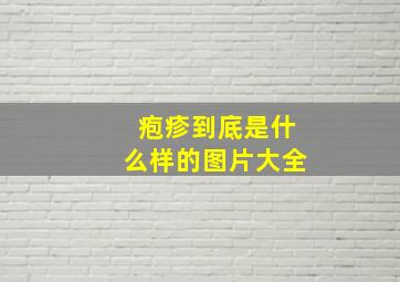 疱疹到底是什么样的图片大全