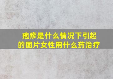 疱疹是什么情况下引起的图片女性用什么药治疗