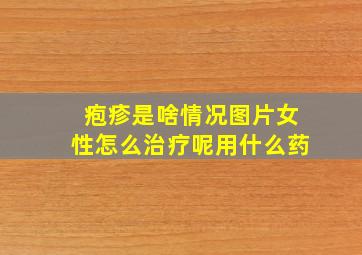 疱疹是啥情况图片女性怎么治疗呢用什么药