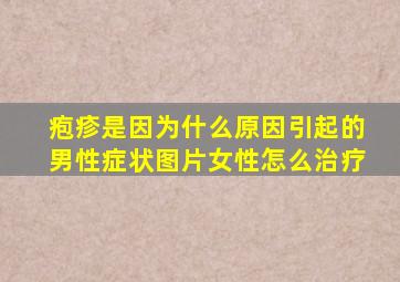 疱疹是因为什么原因引起的男性症状图片女性怎么治疗