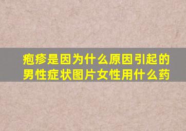 疱疹是因为什么原因引起的男性症状图片女性用什么药