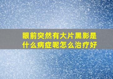 眼前突然有大片黑影是什么病症呢怎么治疗好