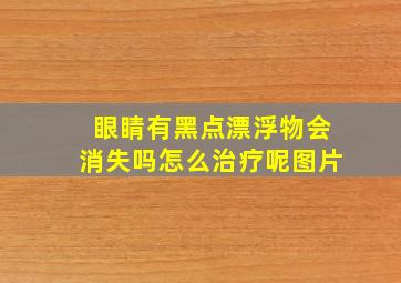 眼睛有黑点漂浮物会消失吗怎么治疗呢图片