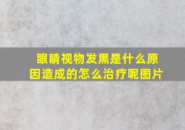 眼睛视物发黑是什么原因造成的怎么治疗呢图片