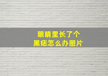 眼睛里长了个黑痣怎么办图片