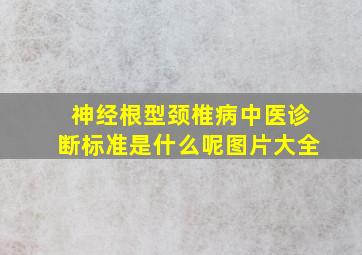 神经根型颈椎病中医诊断标准是什么呢图片大全