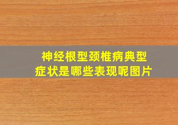 神经根型颈椎病典型症状是哪些表现呢图片