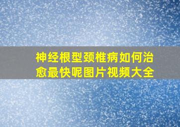 神经根型颈椎病如何治愈最快呢图片视频大全