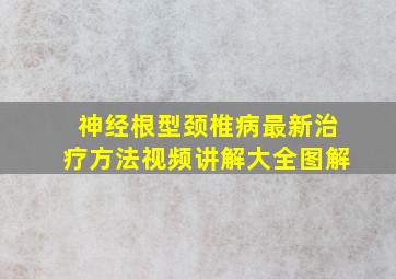 神经根型颈椎病最新治疗方法视频讲解大全图解