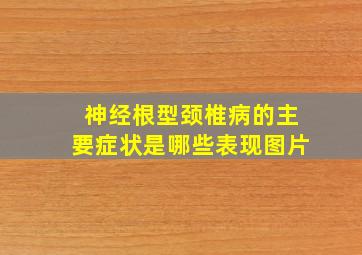 神经根型颈椎病的主要症状是哪些表现图片