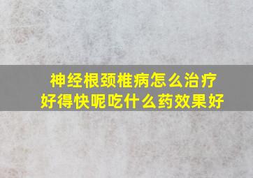 神经根颈椎病怎么治疗好得快呢吃什么药效果好