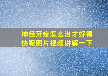 神经牙疼怎么治才好得快呢图片视频讲解一下