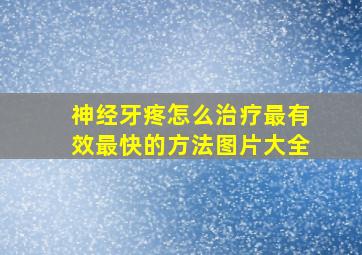 神经牙疼怎么治疗最有效最快的方法图片大全