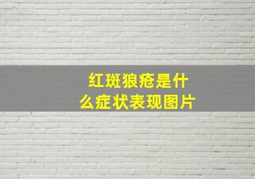 红斑狼疮是什么症状表现图片