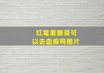 红霉素眼膏可以去血痂吗图片