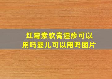 红霉素软膏湿疹可以用吗婴儿可以用吗图片